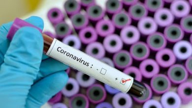 صورة هولندا تسعى لإنجاز 17  ألف اختبار يومي لفيروس كورونا