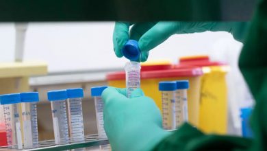 صورة إيطاليا تكشف عن موعد انتاج لقاح ضد فيروس كورونا