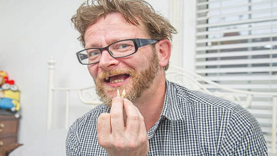 صورة بريطاني يضطر لخلع أسنانه بنفسه.. والسبب أزمة كورونا