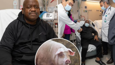صورة بعد شهرين من العملية.. وفاة أول مريض يخضع لزراعة كلية خنزير معدلة وراثيا